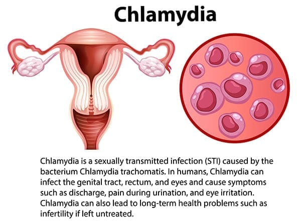 Chlamydia bacteria picture
