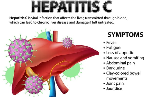Hepatitis C symptoms picture