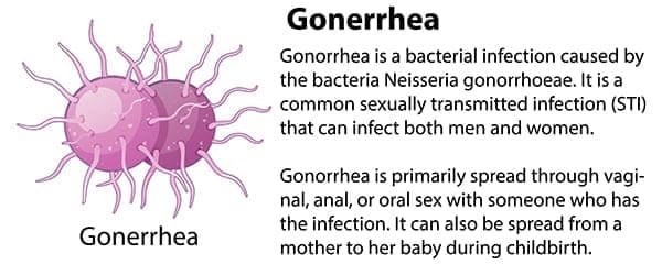 Gonorrhea symptom picture
