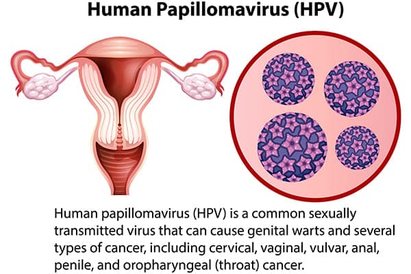 What is Human Papillomavirus