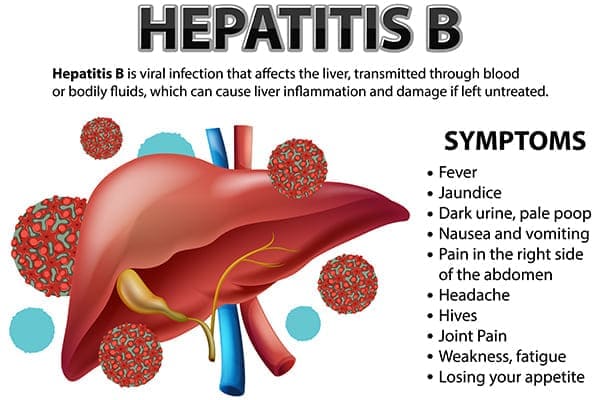 Hepatitis B Symptoms Pictures